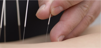 H&Z Acupuncture - Advanced Acupuncture Clinic