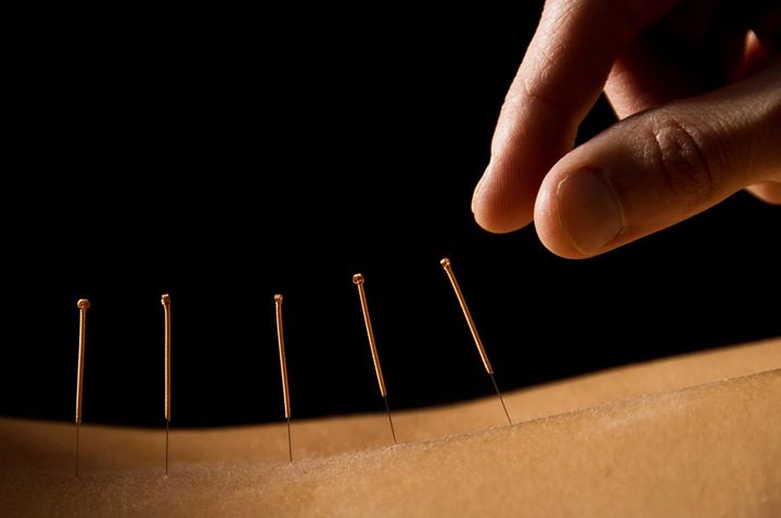 Case Studies - H&Z Acupuncture - Advanced Acupuncture Clinic